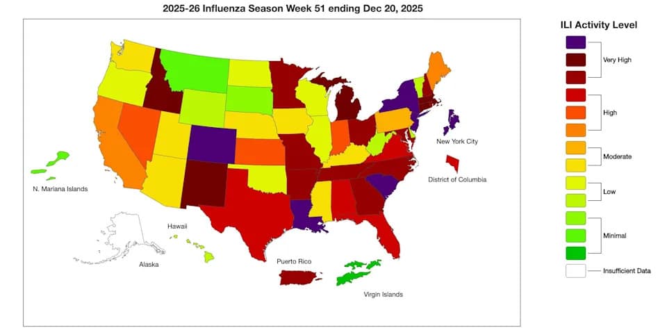 Flu Cases Surge Nationwide This Holiday Season as H3N2 Spreads, CDC Says