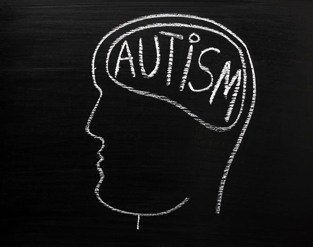 New Study Identifies Four Autism Subtypes Linked to Age of Symptom Onset and Genetics