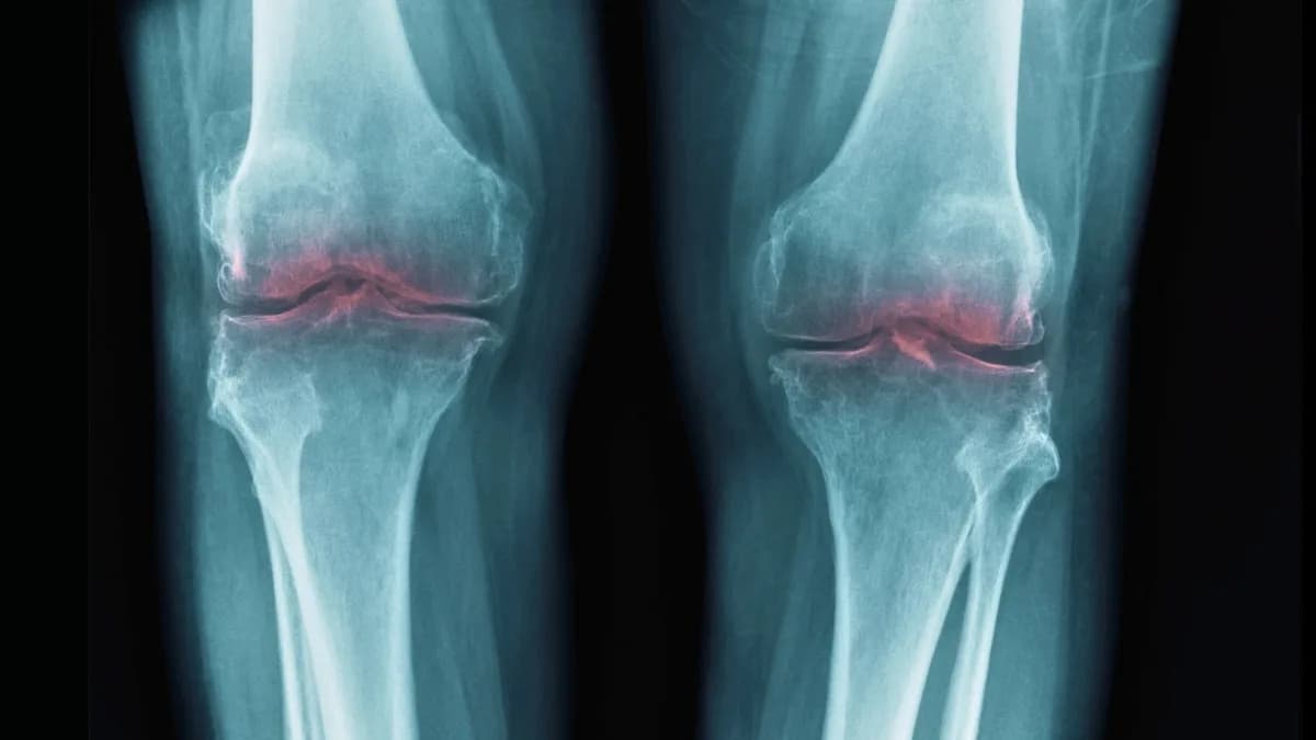 Blocking One Protein Restores Cartilage in Mice — A Promising Path Toward Osteoarthritis Treatments