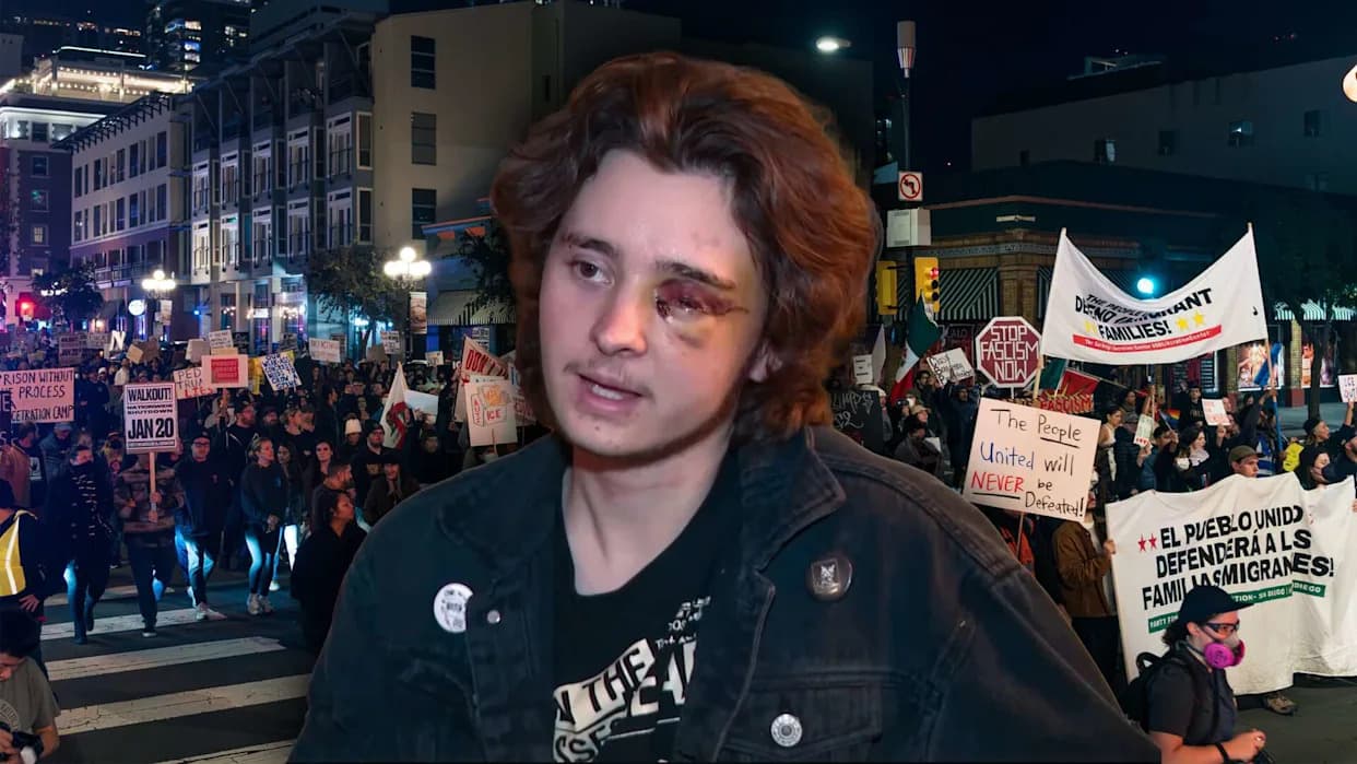 Video: DHS Officer Fires Nonlethal Round Point-Blank — 21-Year-Old Left Blind in One Eye