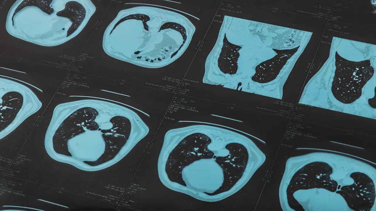 Researchers Raise Major Questions About Several High-Profile Microplastics Studies — What We Know and What’s Unclear