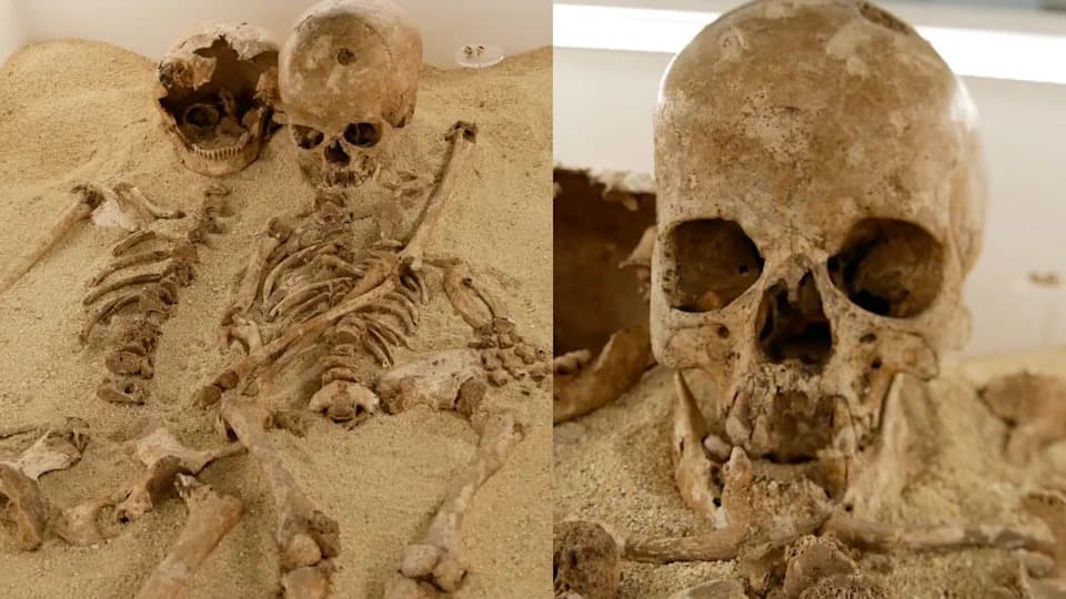 12,000-Year-Old Teen From Italy Had Rare Dwarfism, Ancient DNA Reveals