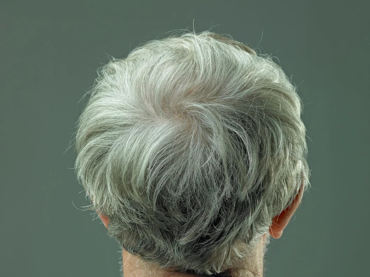 Study in Nature Finds Gray Hair May Be Reversible by Freeing Stuck Stem Cells
