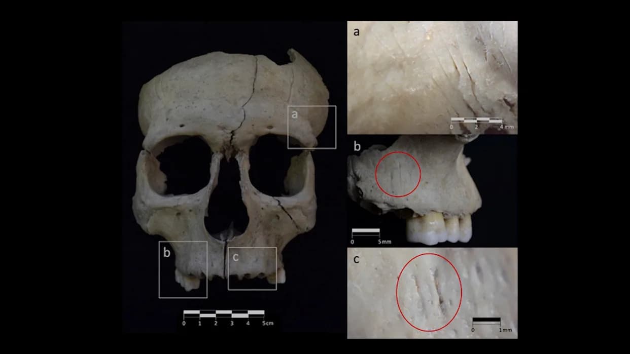 Severed-Head Rituals in Iron Age Iberia Were More Widespread Than Previously Believed