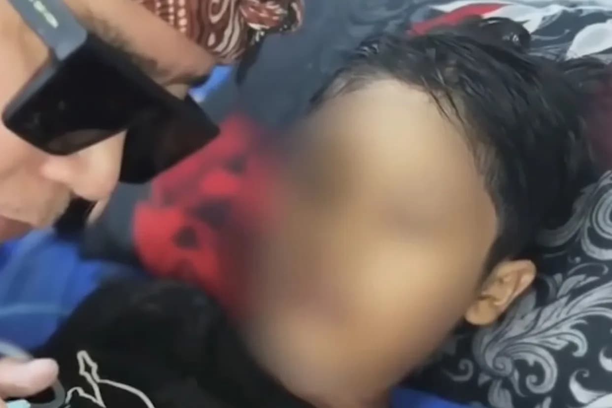 12-Year-Old Dies After Allegedly Being Forced to Drink Boiling Water; Stepmother Named as Suspect