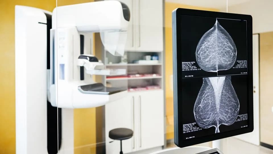 Global Breast Cancer Cases Could Exceed 3.5 Million By 2050 — Study Warns Of Widening Global Divide