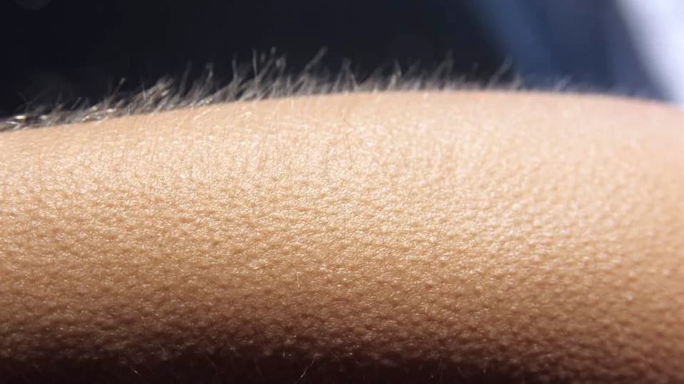 Why We Get Goosebumps: The Old Reflex Behind Hairiness, Music Chills, and Dopamine