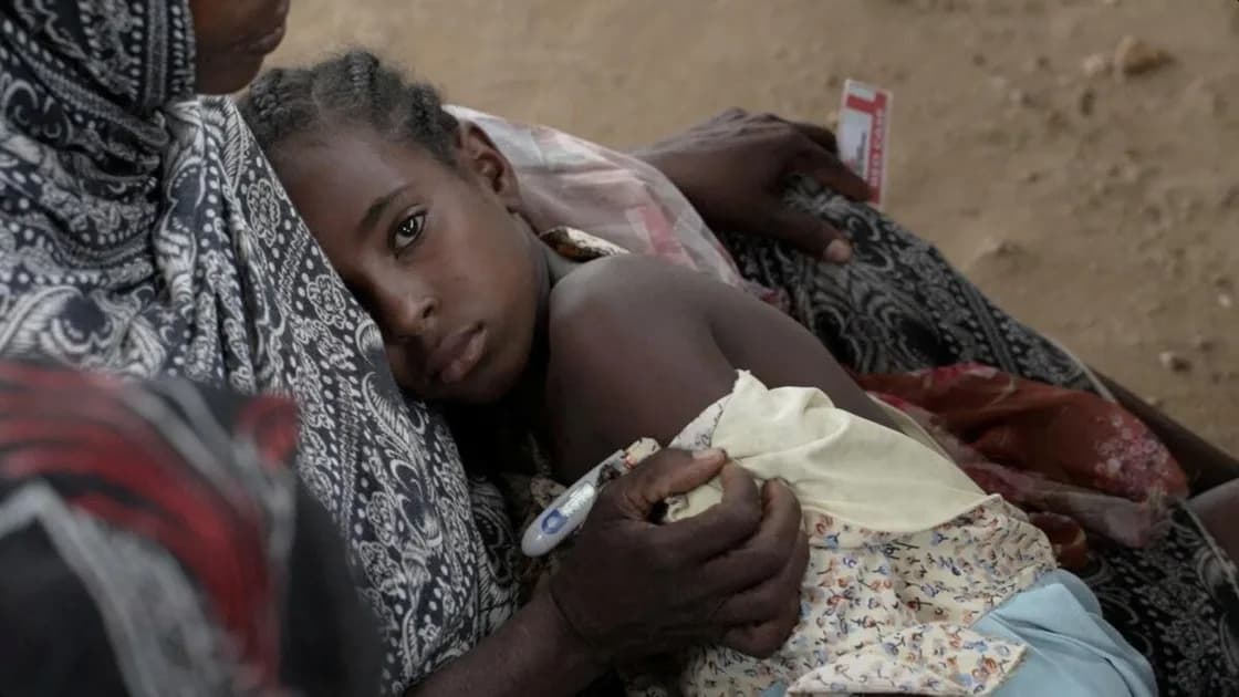 War and Neglect Drive Deadly Measles Outbreak in Sudan’s Darfur — Labado Faces Humanitarian Crisis