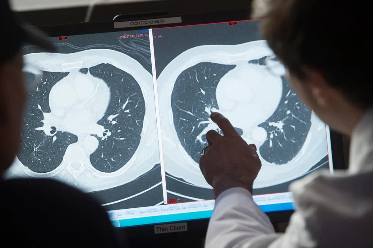 New Cancer Injection Amivantamab Produces ‘Unprecedented’ Tumor Responses in Multinational Trial