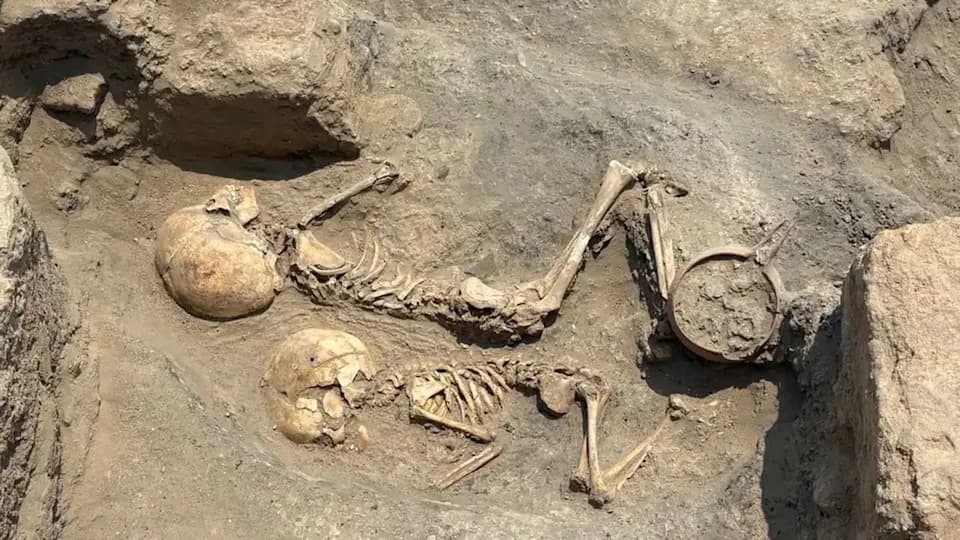 4,000-Year-Old Bronze Age Child's Skull Reveals Earliest Known Cranial Surgery in Central Asia