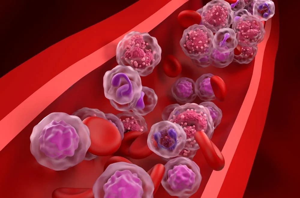 ASCO26: MeziKd and Tecvayli Deliver Major Efficacy Gains in Multiple Myeloma