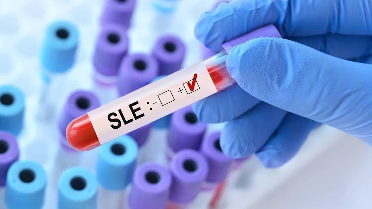 J&J’s Nipocalimab Hits Primary Endpoint in Phase II JASMINE Trial, Shows Sustained 52‑Week Benefit in SLE