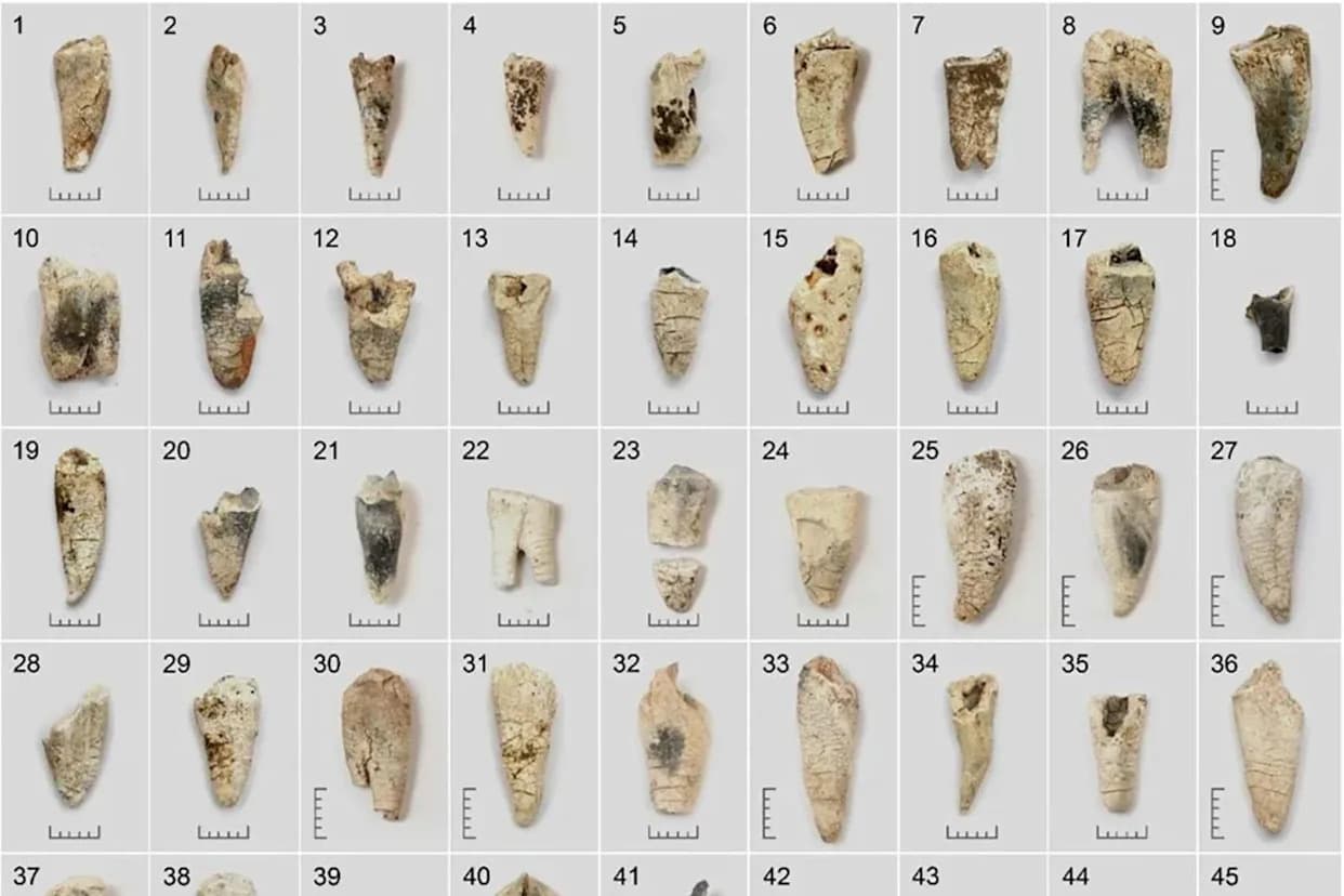 Burned Teeth Tell Time: 3,000-Year-Old Urn Burials Reveal How To Estimate Age At Death