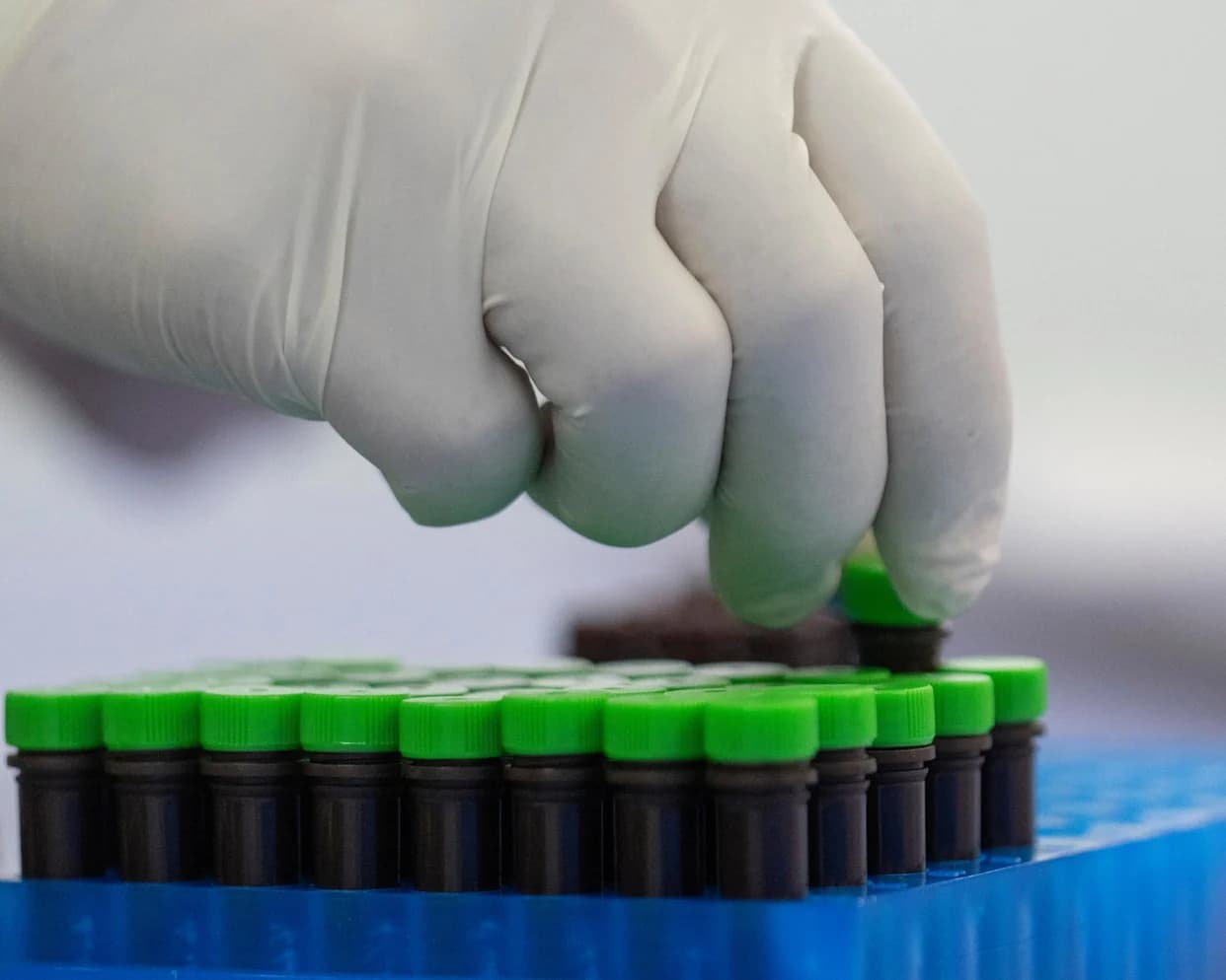 Congress Probes NIH After Two Rocky Mountain Labs Scientists Charged With Alleged Mpox Smuggling