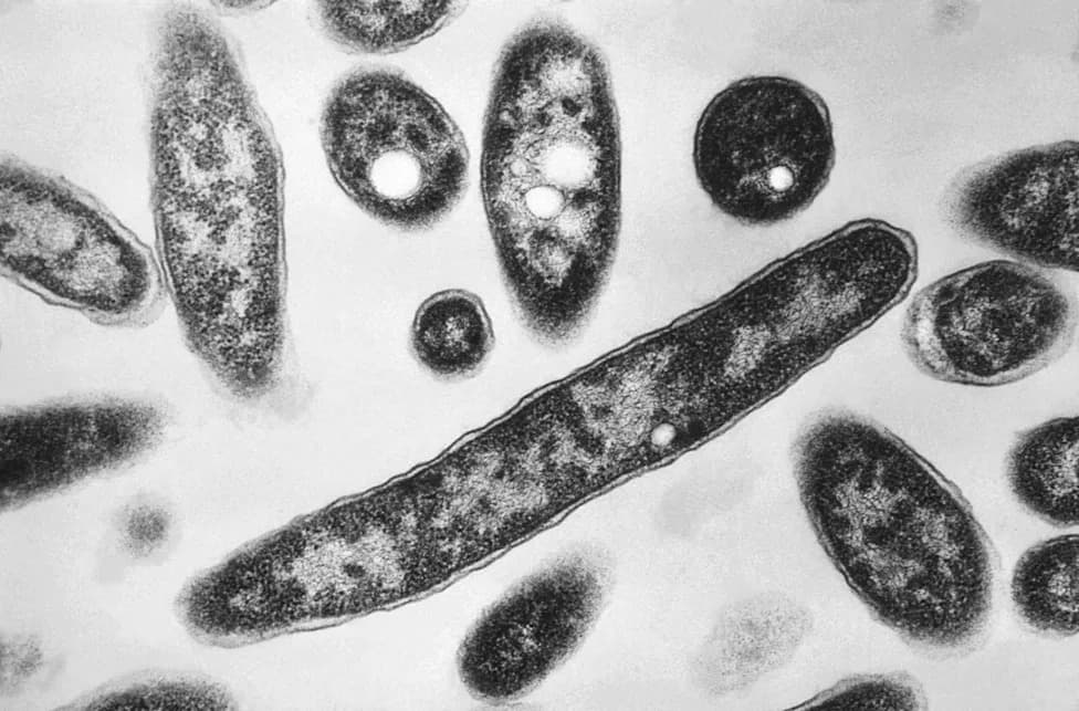 First Death Confirmed in New York City's Upper East Side Legionnaires Outbreak