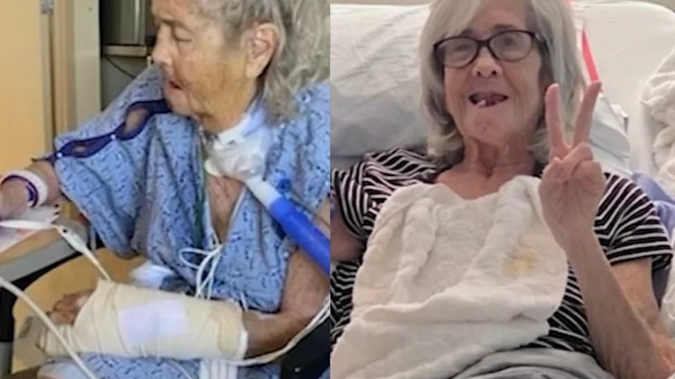 72-Year-Old Pedestrian Severely Injured By Teen On Sur‑Ron E‑Motorcycle; She Urges Better Rules