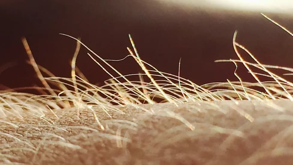 Study Finds 'Peach Fuzz' Hairs May Form a Dedicated Itch-Sensing Organ