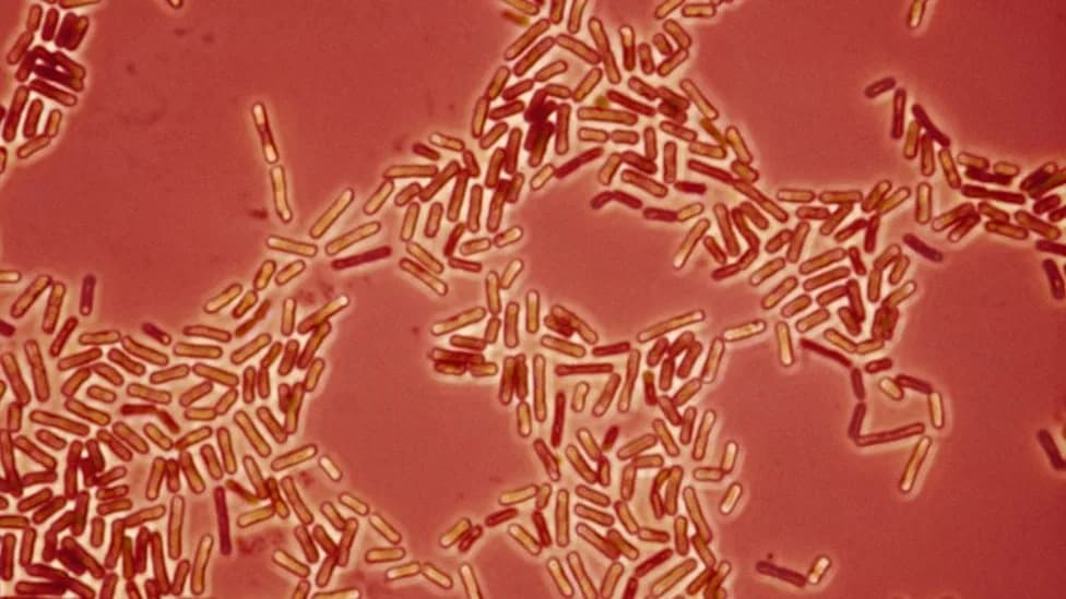 Drug-Resistant Acinetobacter May Move Between Pets and People, Study Warns