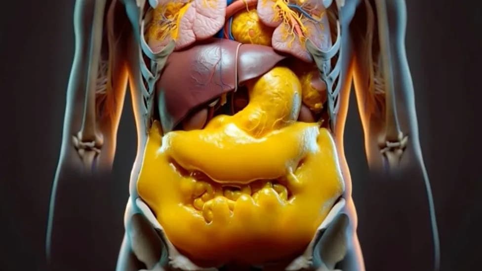 Where You Store Body Fat Predicts Brain Aging — Large Study Links Visceral Fat To White-Matter Damage