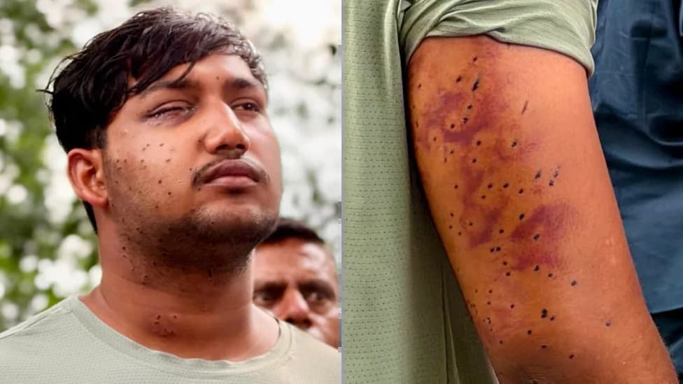 Ballistics Experts Say Wounds From Delhi Protesters Are Consistent With Pellet-Gun (Birdshot) Fire