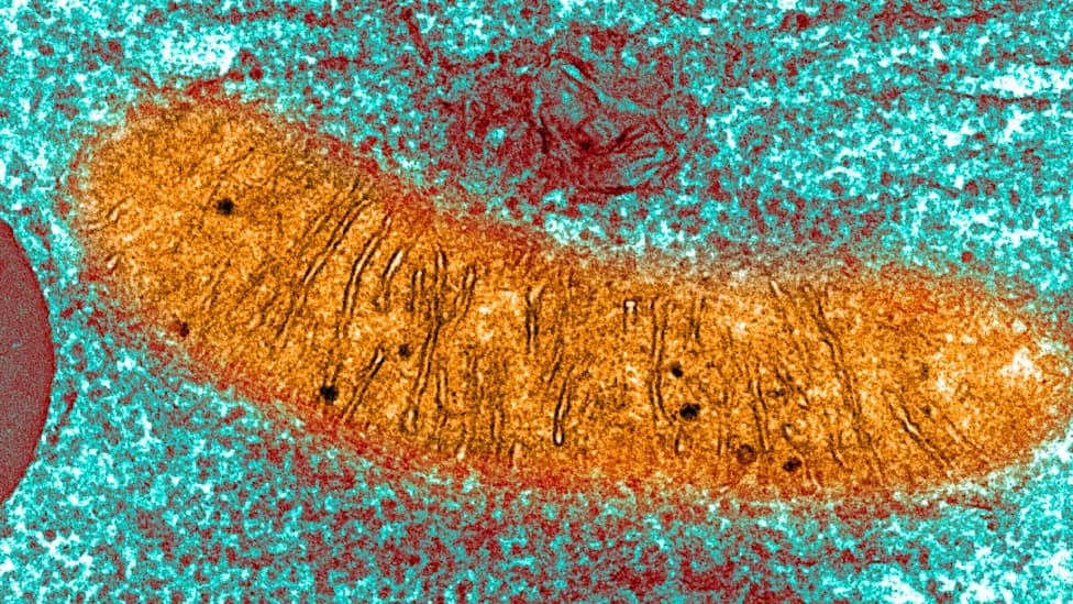 Scientists Discover Mitochondrial "Plaques" in Neurons Linked to Alzheimer's Progression