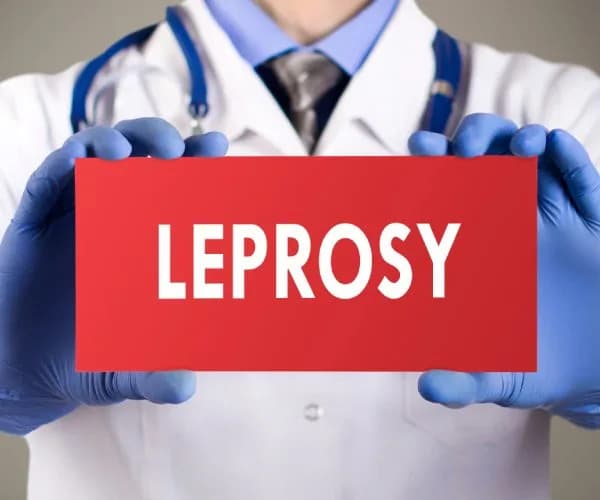 Leprosy Resurges in Florida: Officials Point to Armadillos as Likely Source