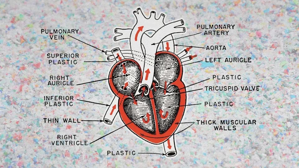 Microplastics Found In 84% Of Heart Attack Patients — Could Tiny Plastics Be Harming Hearts?