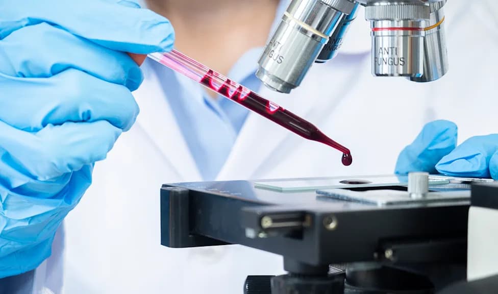 Johns Hopkins Validates AI Blood Test (DELFI) That Detects Liver Cancer Across Two High-Risk Populations
