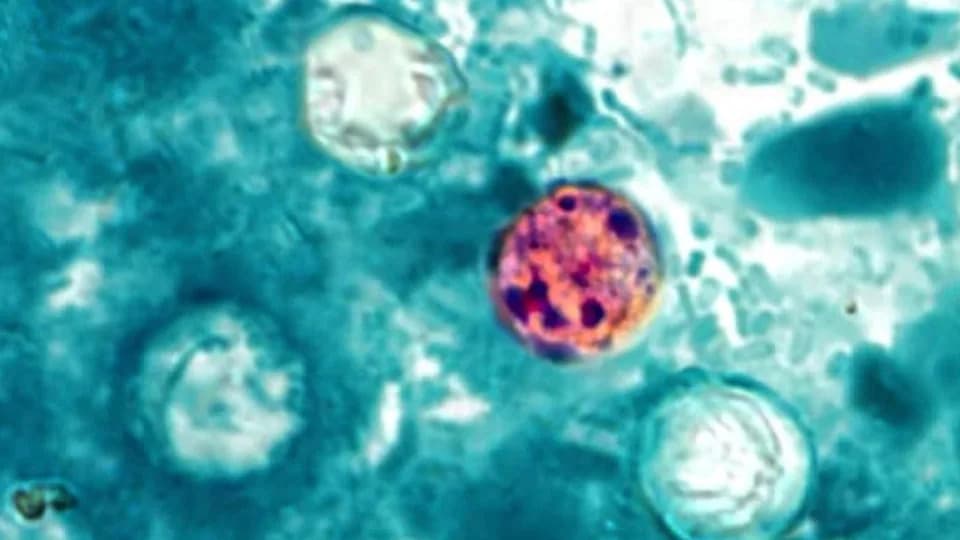 Sharp Rise in Cyclosporiasis Among UK Travelers Linked to Mexico; US Outbreak Tied to Lettuce