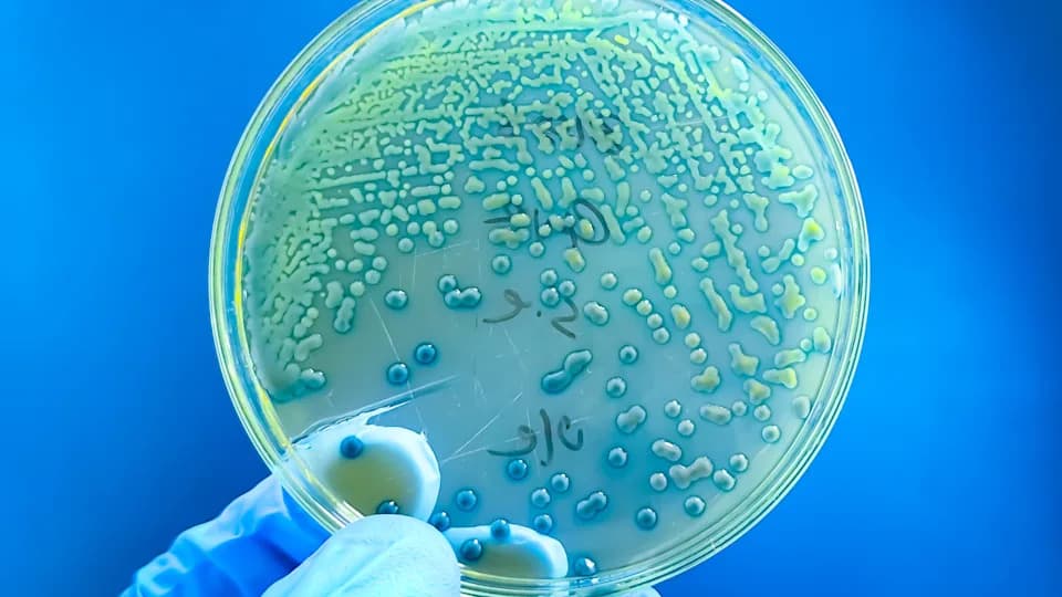 Global Rise in Antibiotic Resistance Among Children: Major Study Warns Of Growing Threat
