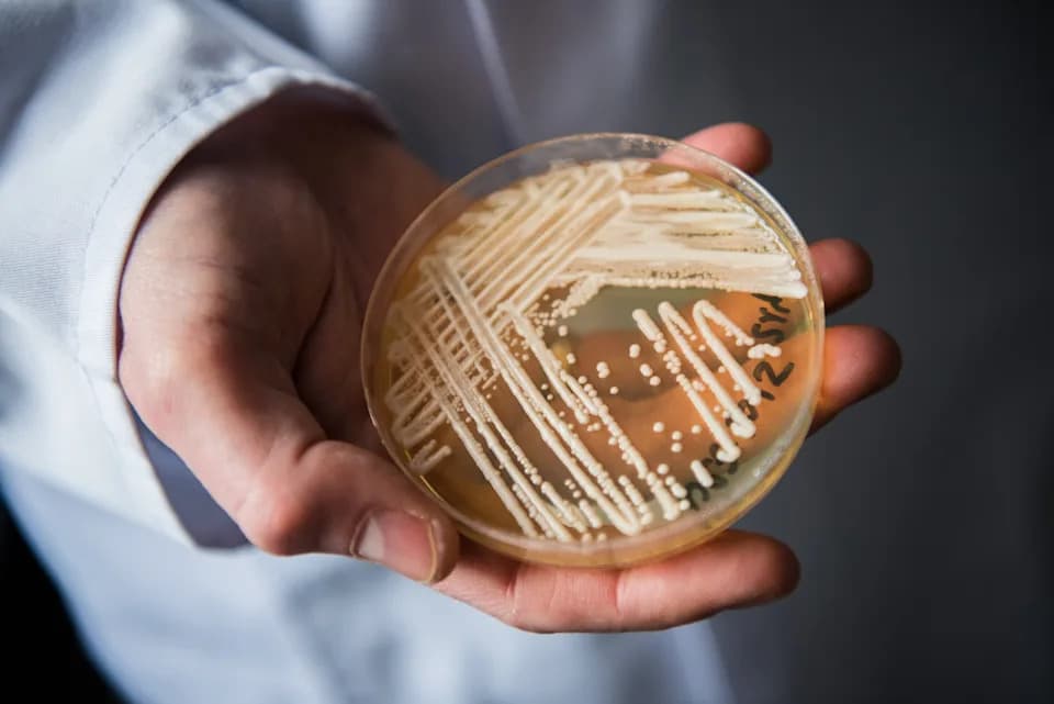 Candida auris Found in 27 U.S. States: What Patients and Care Facilities Need to Know