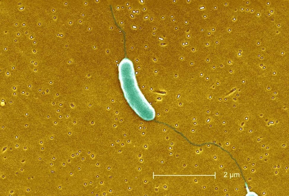 Flesh-Eating Vibrio Bacteria Tied to Five Deaths in Louisiana This Year, Officials Say