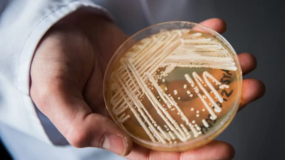 CDC: 3,130 Candida auris Screening Cases Across 23 States as Drug-Resistant Fungus Spreads