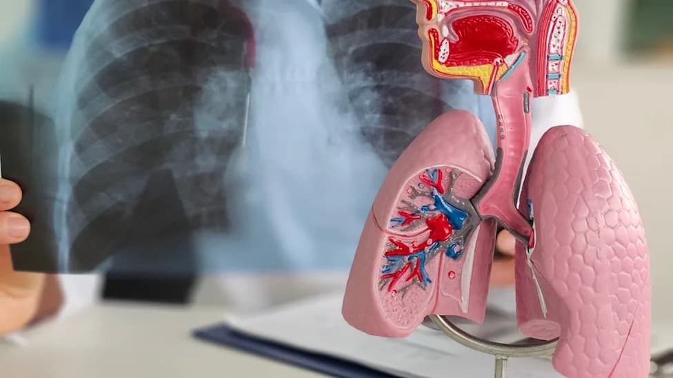 FDA Grants Breakthrough Designation to Freenome's SimpleScreen Lung — Blood Test Could Expand Early Lung Cancer Screening
