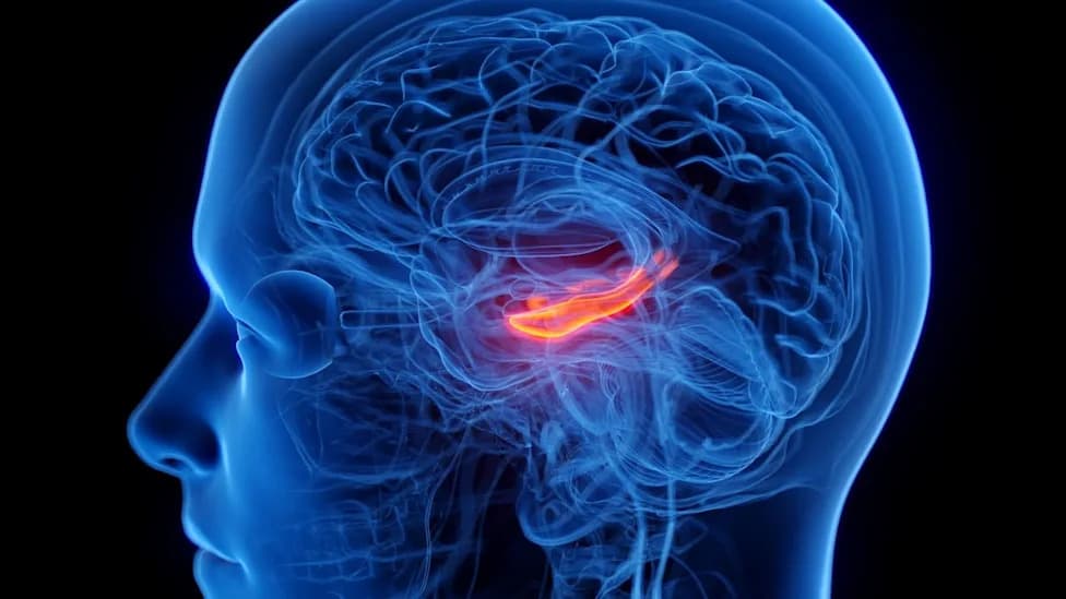 Specific Hippocampal Subregion (CA23DG) Is Smaller in People With Depression, Study Finds