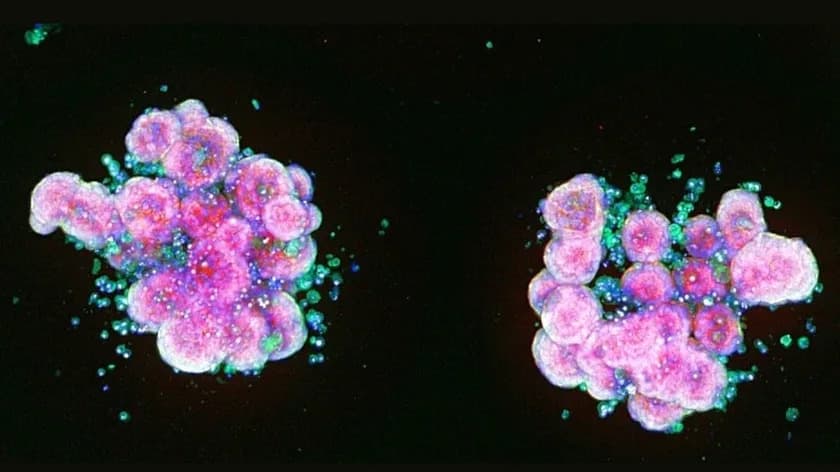 £20m Cambridge Hub to Accelerate Drug Discovery Using AI and Human Tissue Models