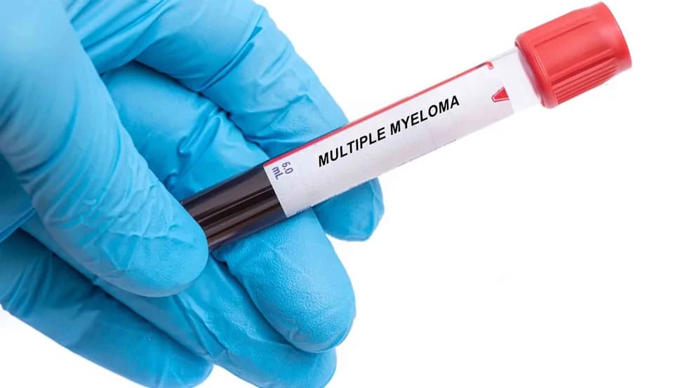 European Commission Approves Tecvayli (Teclistamab) Plus Daratumumab After Phase III MajesTEC‑3 Shows Large Survival Benefit