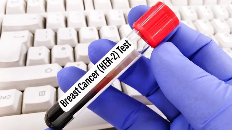FDA Clears Ziihera for First-Line Treatment of Advanced HER2+ Gastroesophageal Adenocarcinoma