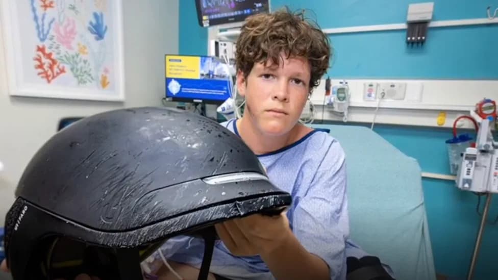 Last‑Minute Helmet Swap Likely Saved Teen After E‑Bike Flies Over Car Hood