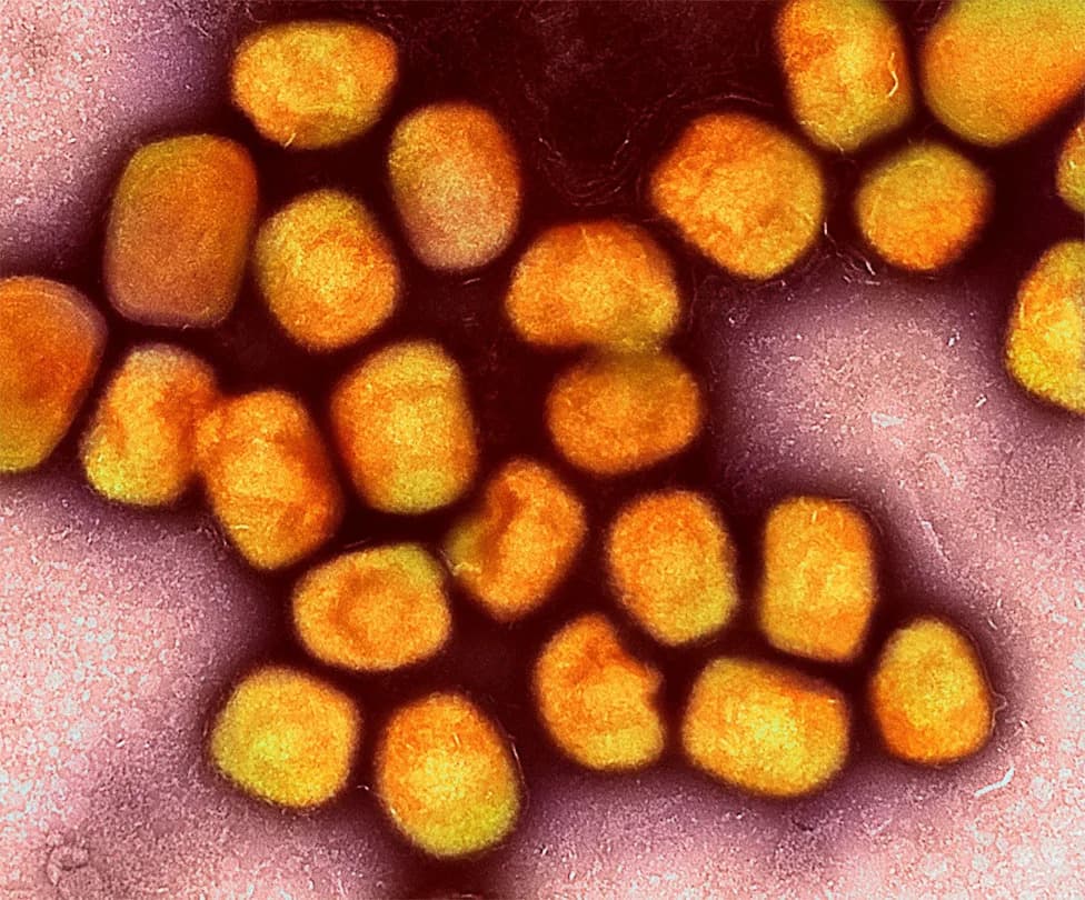 Mpox Spreads Into New Sexual Networks in Berlin — Officials Warn Unvaccinated Groups At Risk