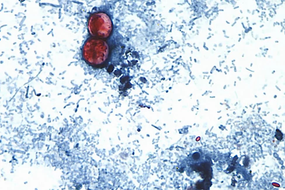 FDA: Cyclospora From Recalled Iceberg Lettuce Confirmed In 20 States, Thousands Sickened