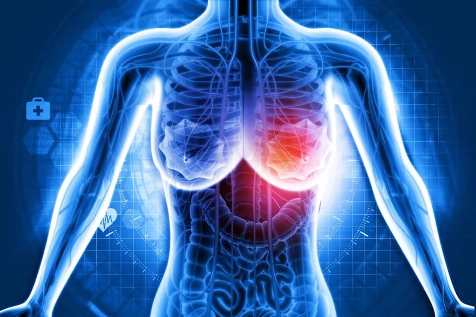 Researchers Expose a New Weakness in Aggressive Triple‑Negative Breast Cancer