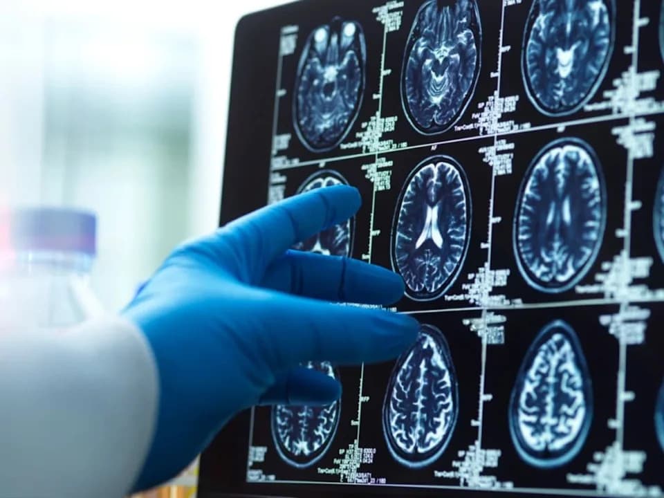 FDA Clears PrecivityAD2 Blood Test to Help Diagnose Alzheimer’s in Symptomatic Adults 40+