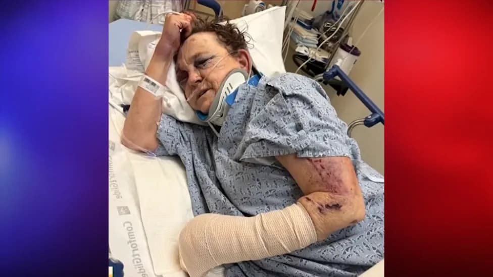 Crestline Grandmother Severely Beaten After Letting Stranger Stay; Suspect Sought