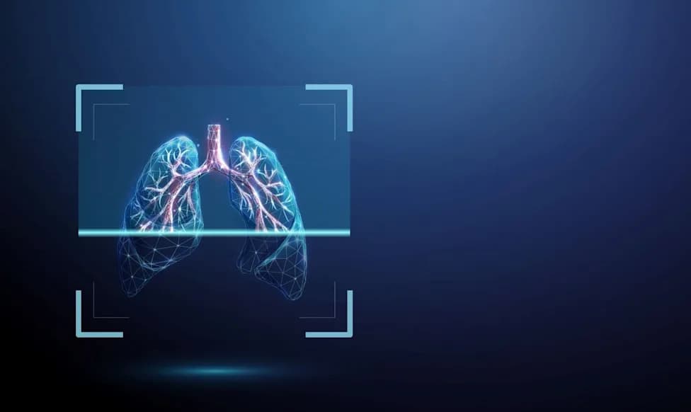 AI Quantitative CT Detects Efficacy Signal for IPF Drug Candidate in Phase IIa Trial
