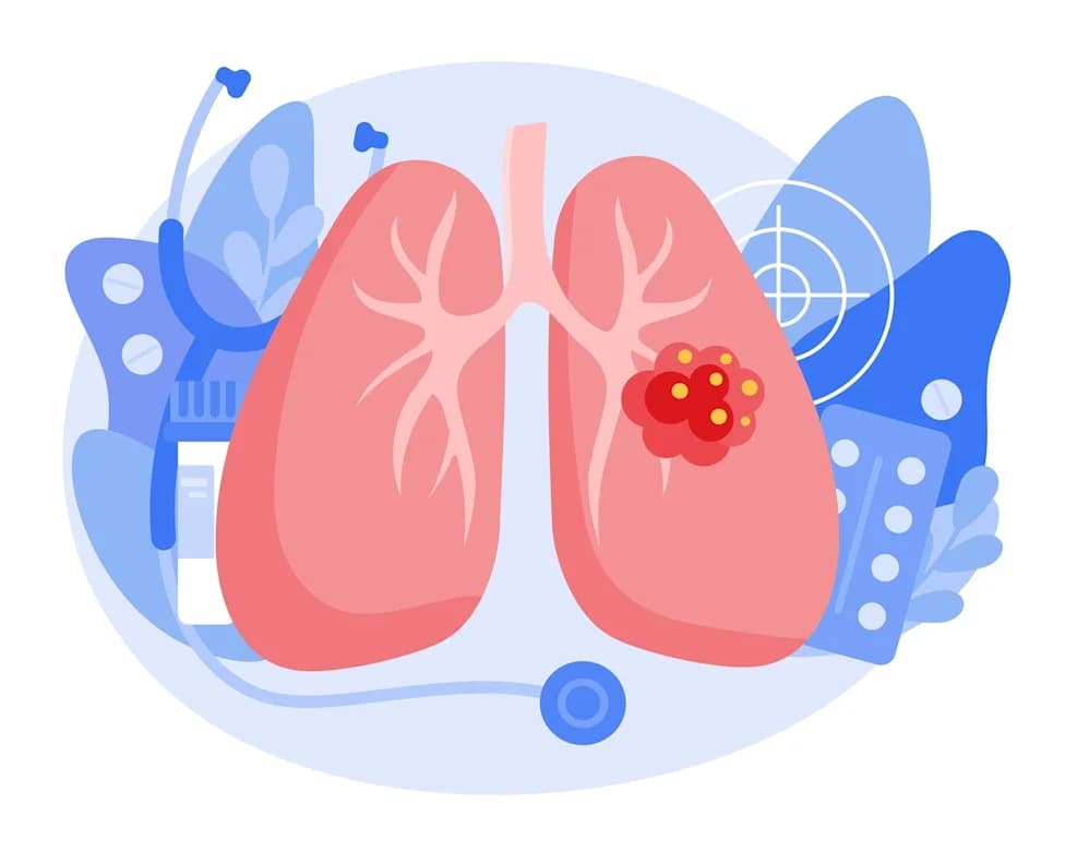 Bayer’s Hyrnuo (Sevabertinib) Wins Accelerated FDA Frontline Approval for HER2‑Mutant NSCLC