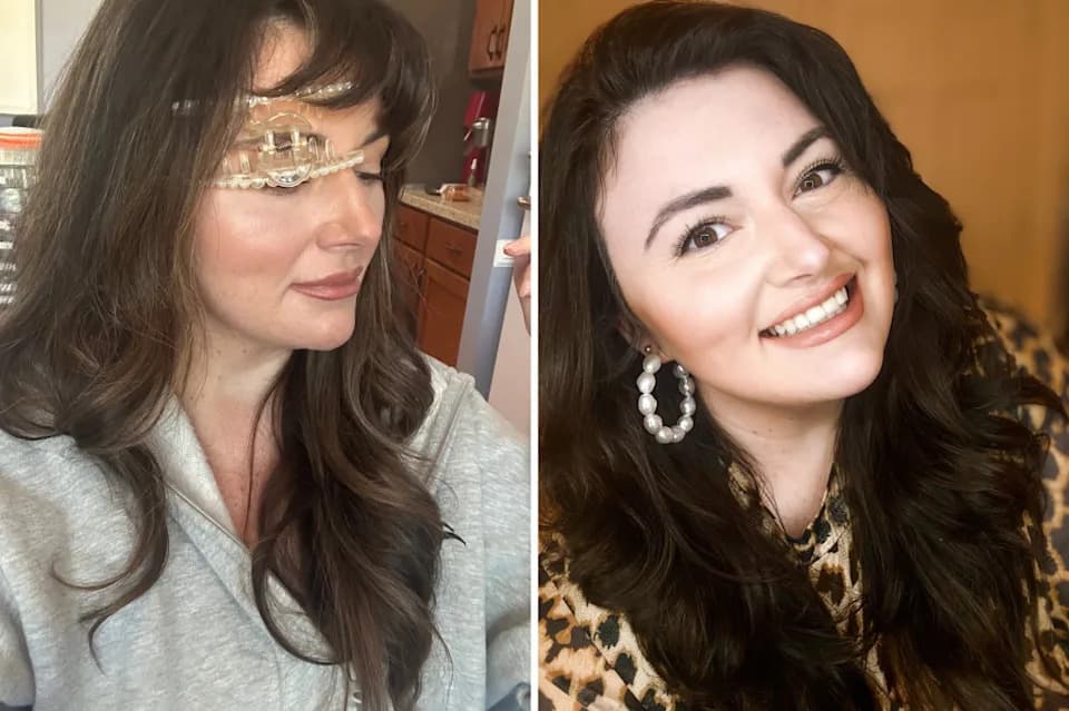 TikTok Comment Helps Solve Nine Years of Daily Headaches: Binocular Vision Dysfunction Diagnosed