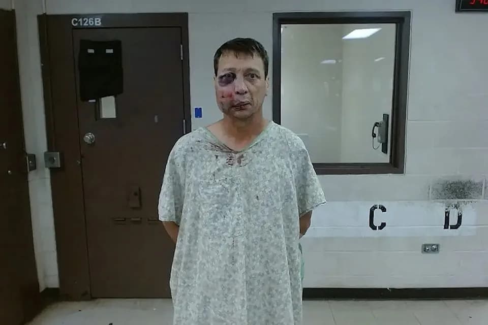 Wichita Golf-Course Brawl Leaves Man With Severe Facial Injuries; Multiple Charges Filed