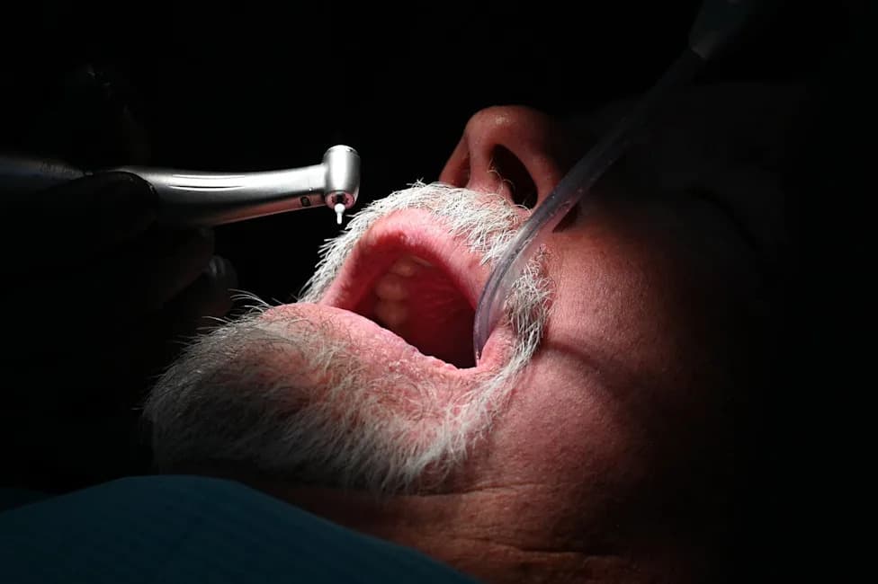 Severe Gum Bleeding and Receding Gums Linked to Over 50% Higher Dementia Risk in Older Adults