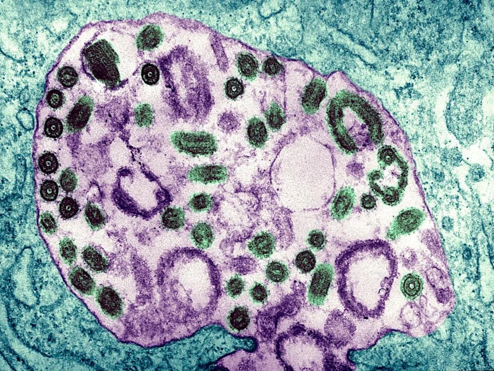 Variant U: The Marburg Strain That Killed a Scientist—and Lingered in a Cold War Lab